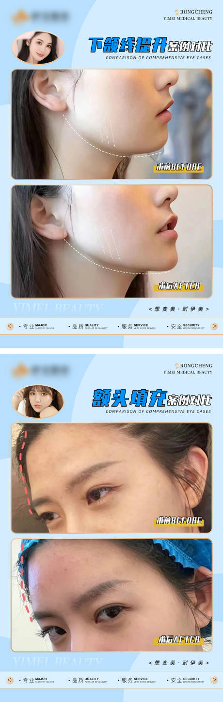 源文件下载【享设计】搜索编号：80770018224163239【医美案例对比模版】