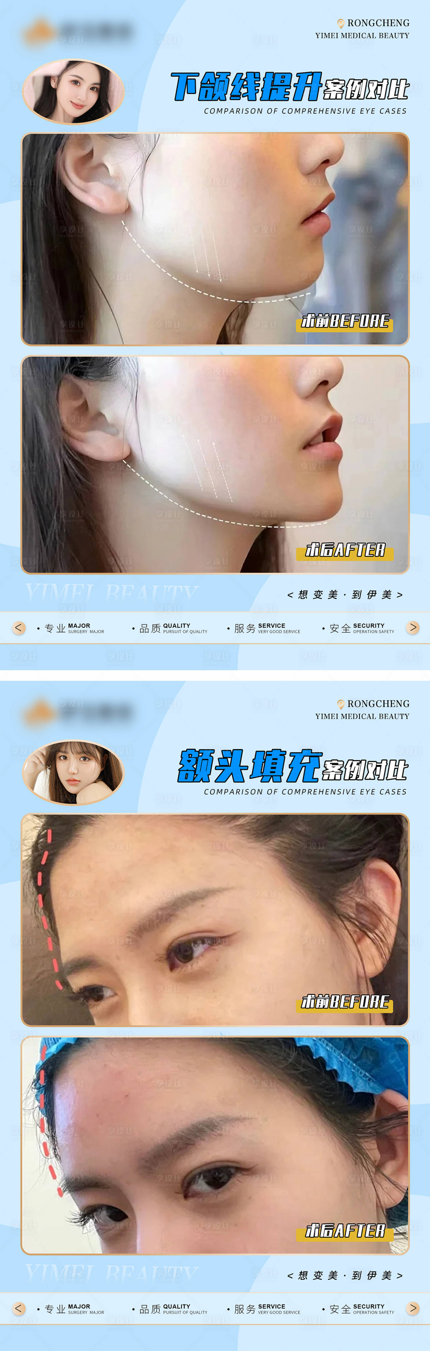 源文件下载【享设计】搜索编号：80770018224163239【医美案例对比模版】