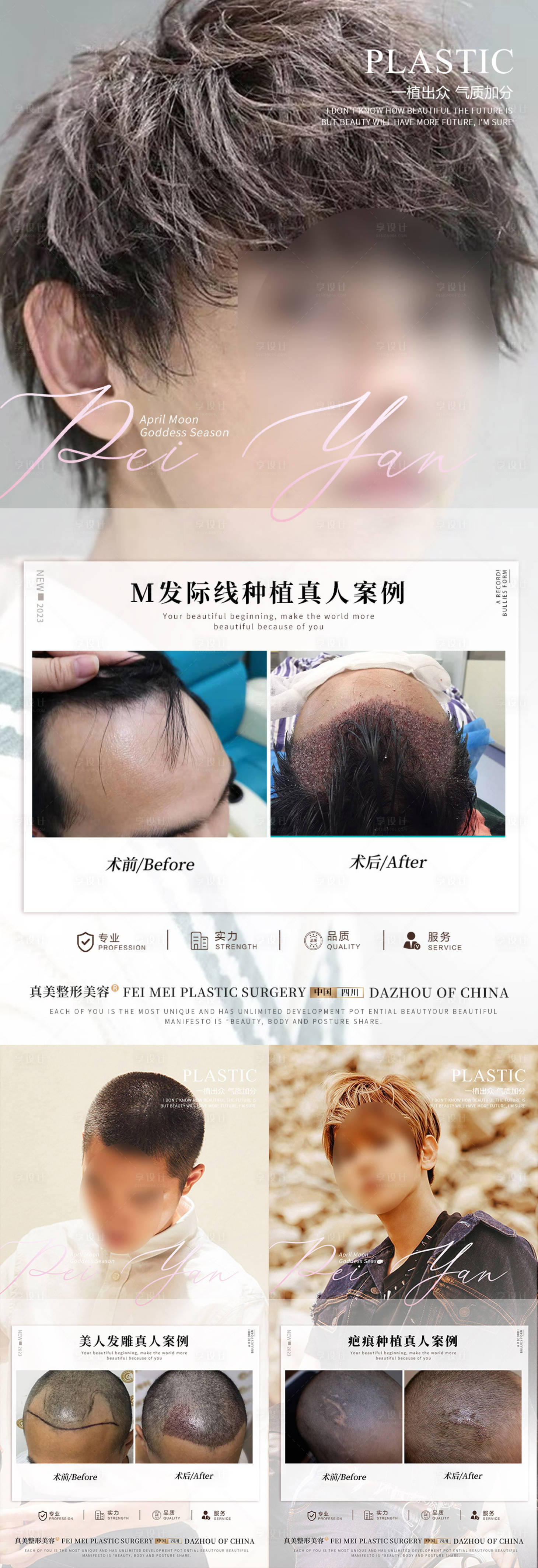 源文件下载【享设计】搜索编号：13000018008903793【植发案例系列海报】