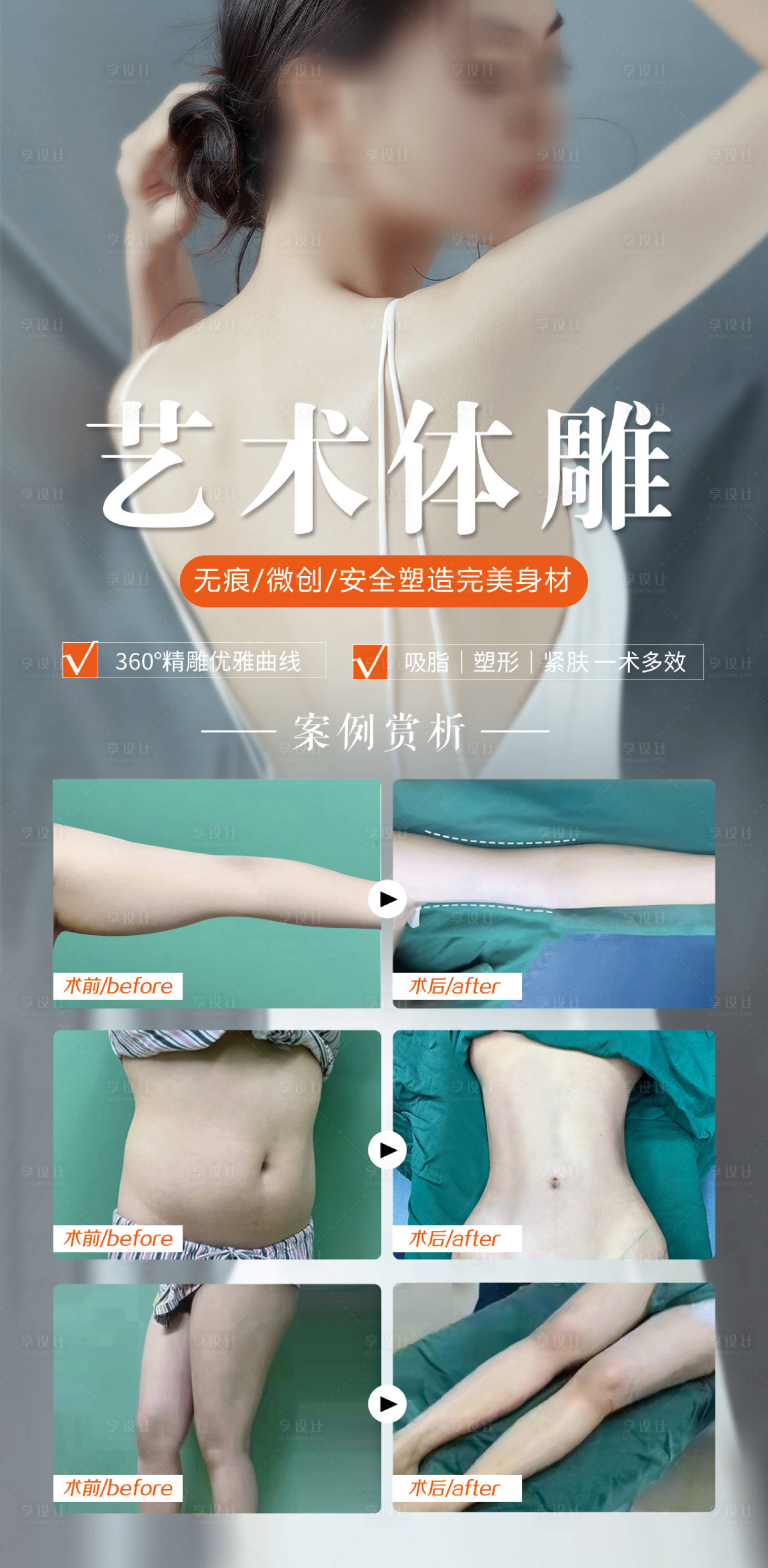 源文件下载【享设计】搜索编号：31290018317151448【吸脂塑形艺术体雕案例海报】