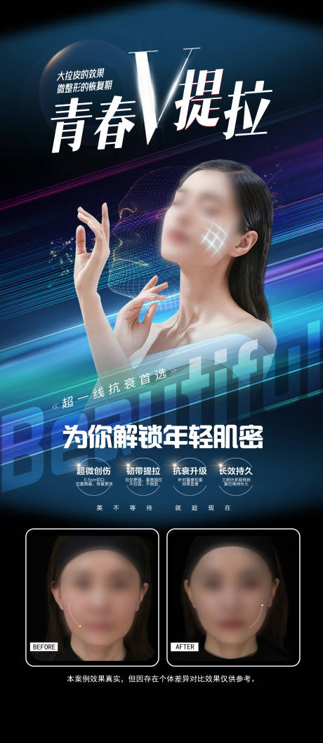 源文件下載【享設計】搜索編號：45000018288719993【醫美案例海報】