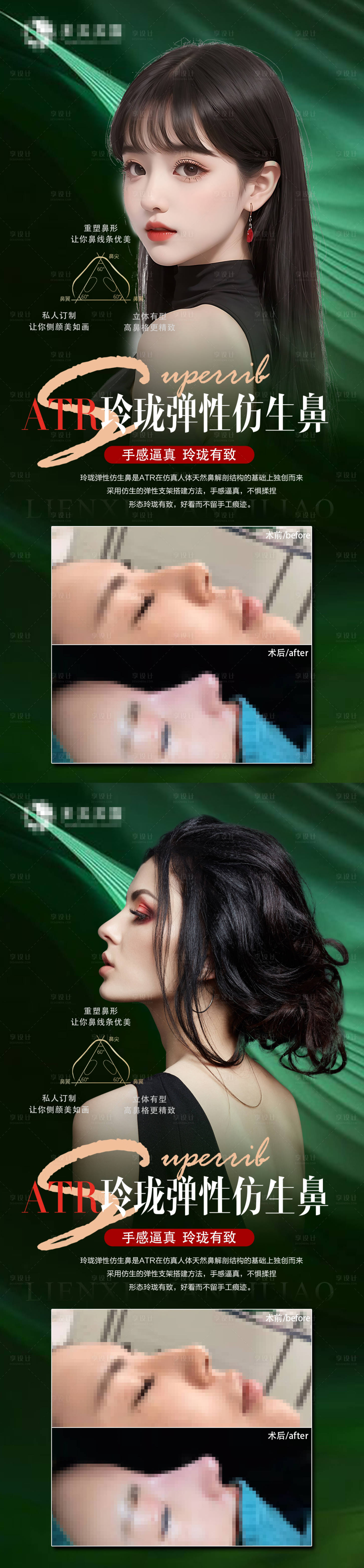 源文件下载【享设计】搜索编号：50840017928962820【医美隆鼻案例海报】