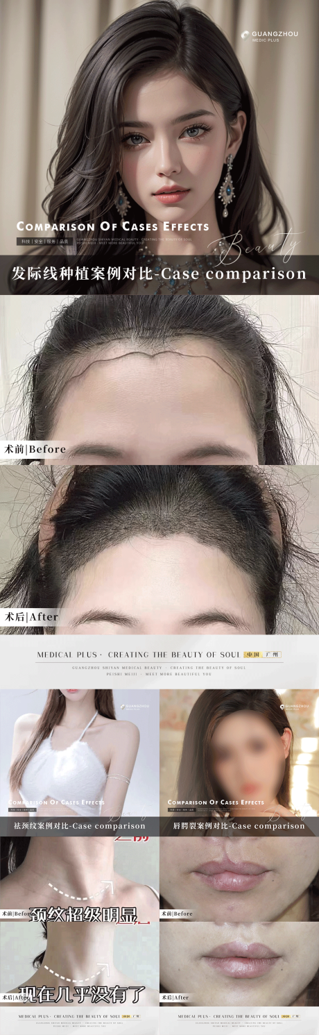 源文件下载【医美植发整形案例对比系列海报】编号：77310017980245645