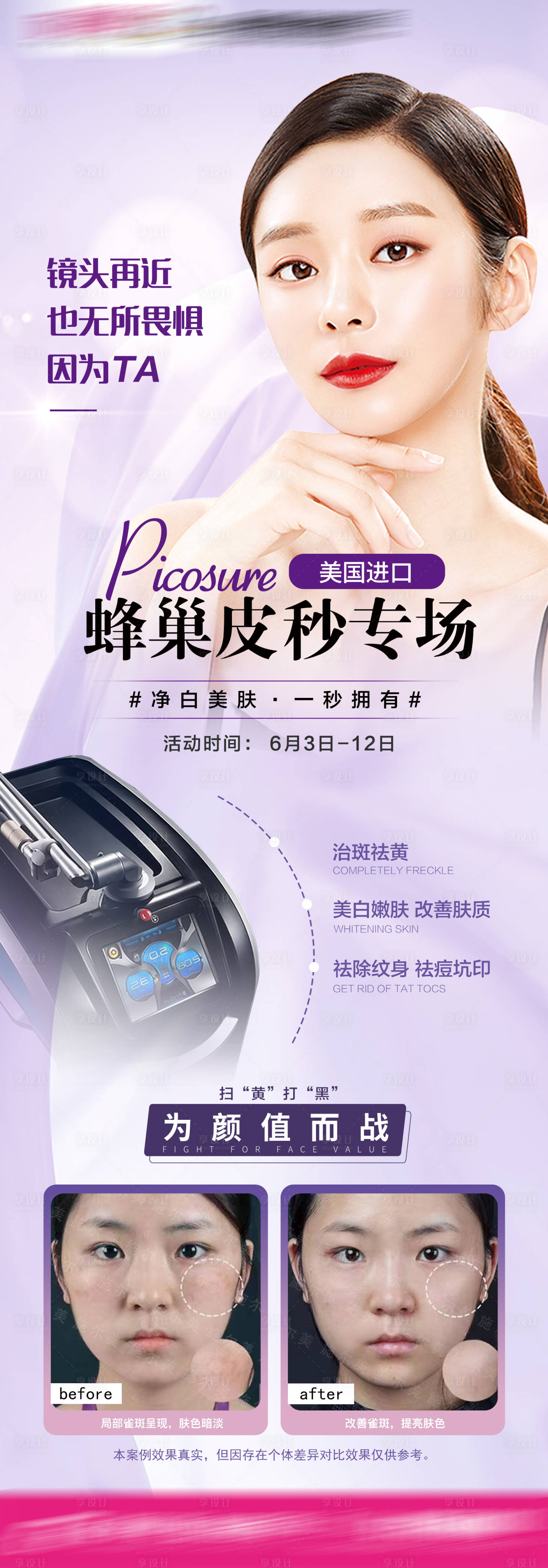 源文件下載【享設計】搜索編號：63130018151589084【蜂巢皮秒祛斑長圖海報】