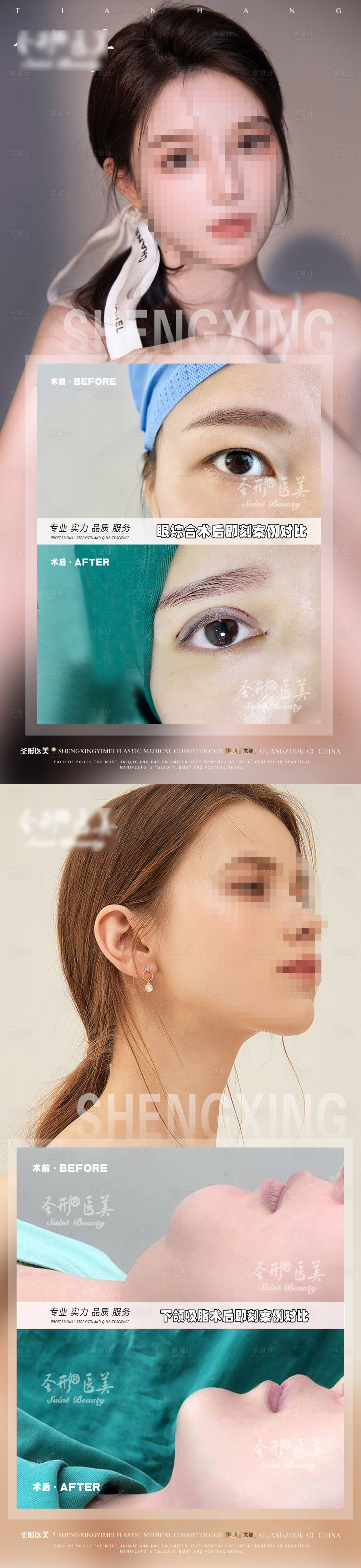 源文件下載【享設(shè)計】搜索編號：57720018178795604【醫(yī)美眼綜合案例海報 】