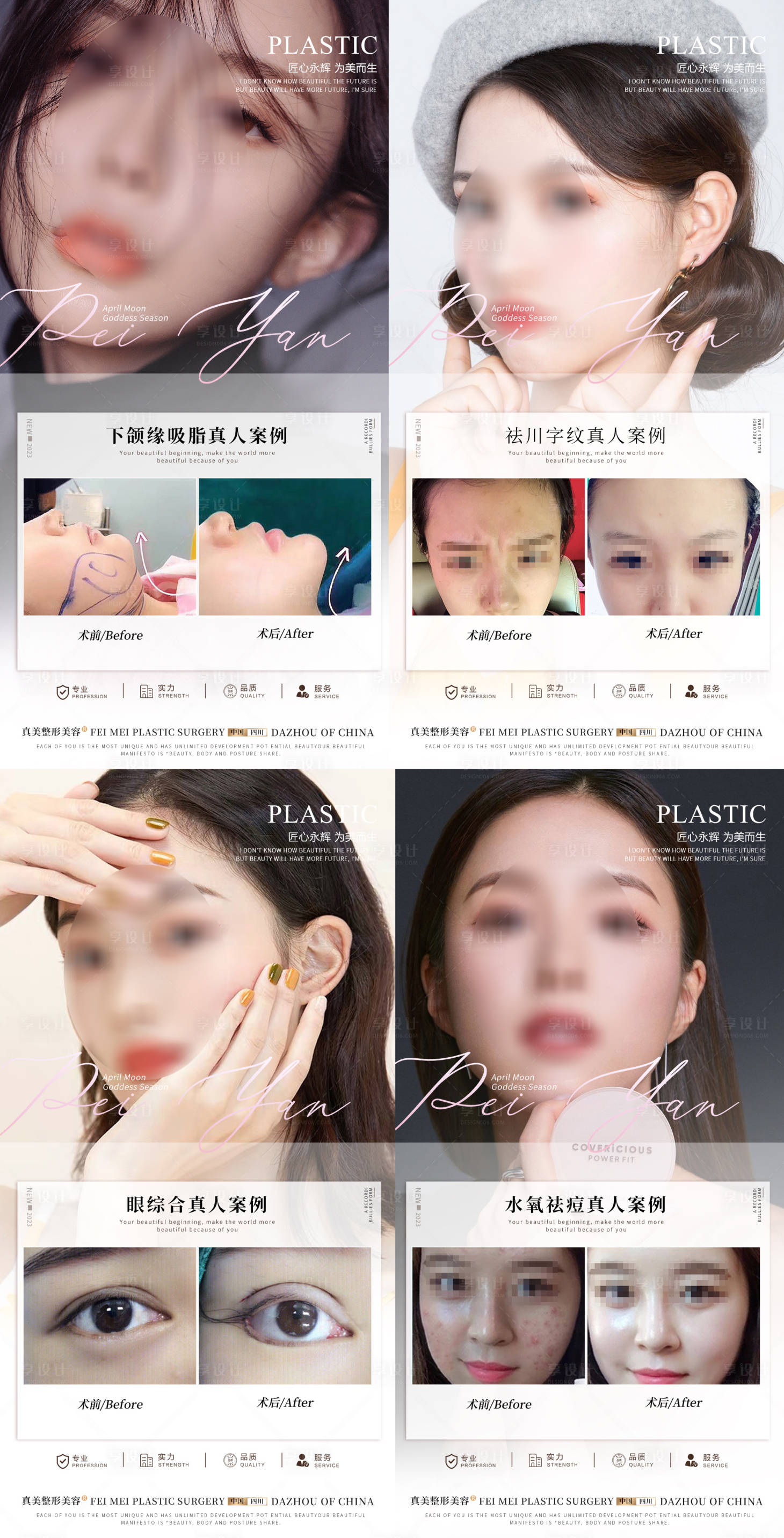 源文件下載【享設計】搜索編號：66120018327134823【整形案例合集】