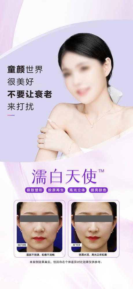 源文件下載【享設(shè)計(jì)】搜索編號：49940018166246650【醫(yī)美案例海報(bào)】