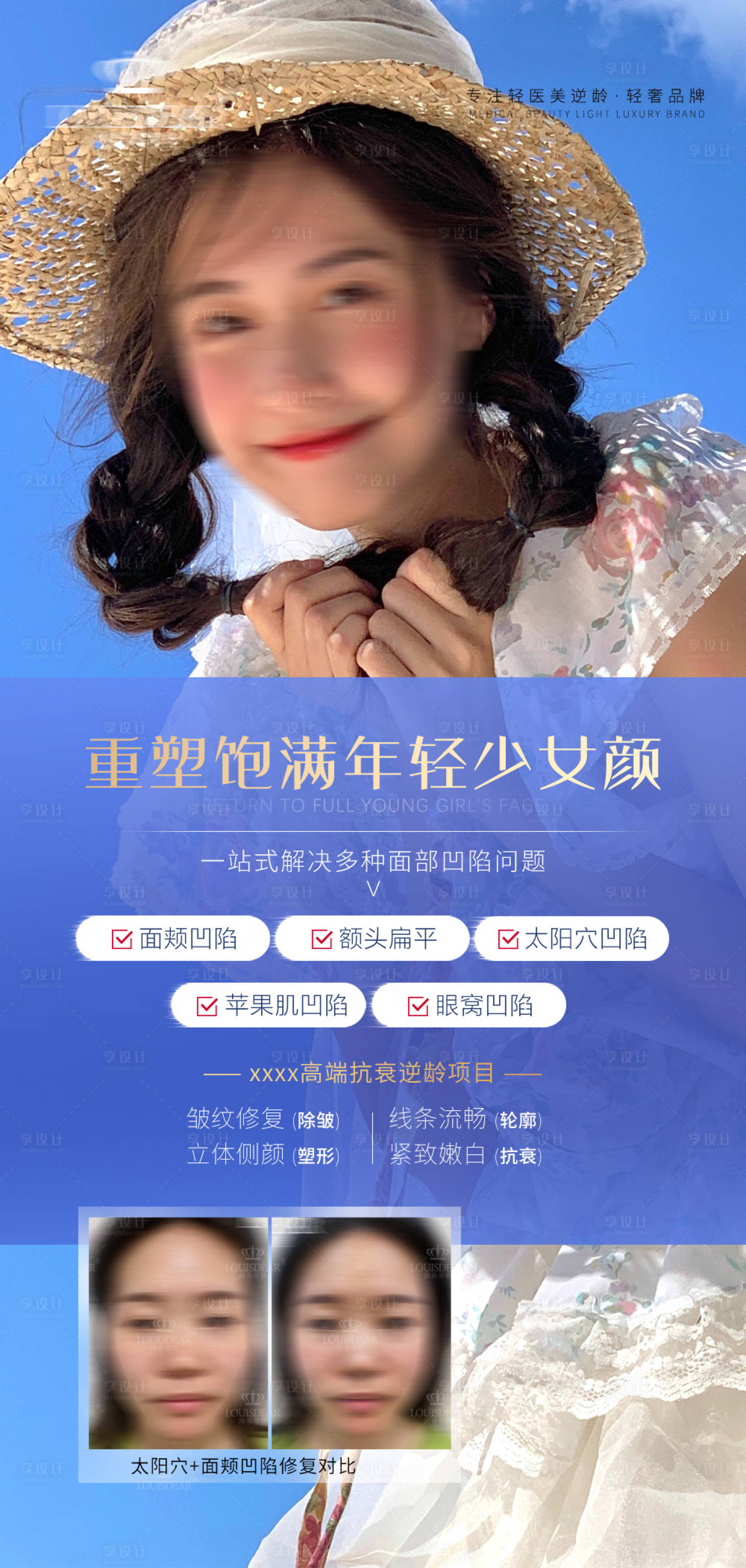 源文件下载【享设计】搜索编号：43020018386474807【医美面部凹陷填充海报】