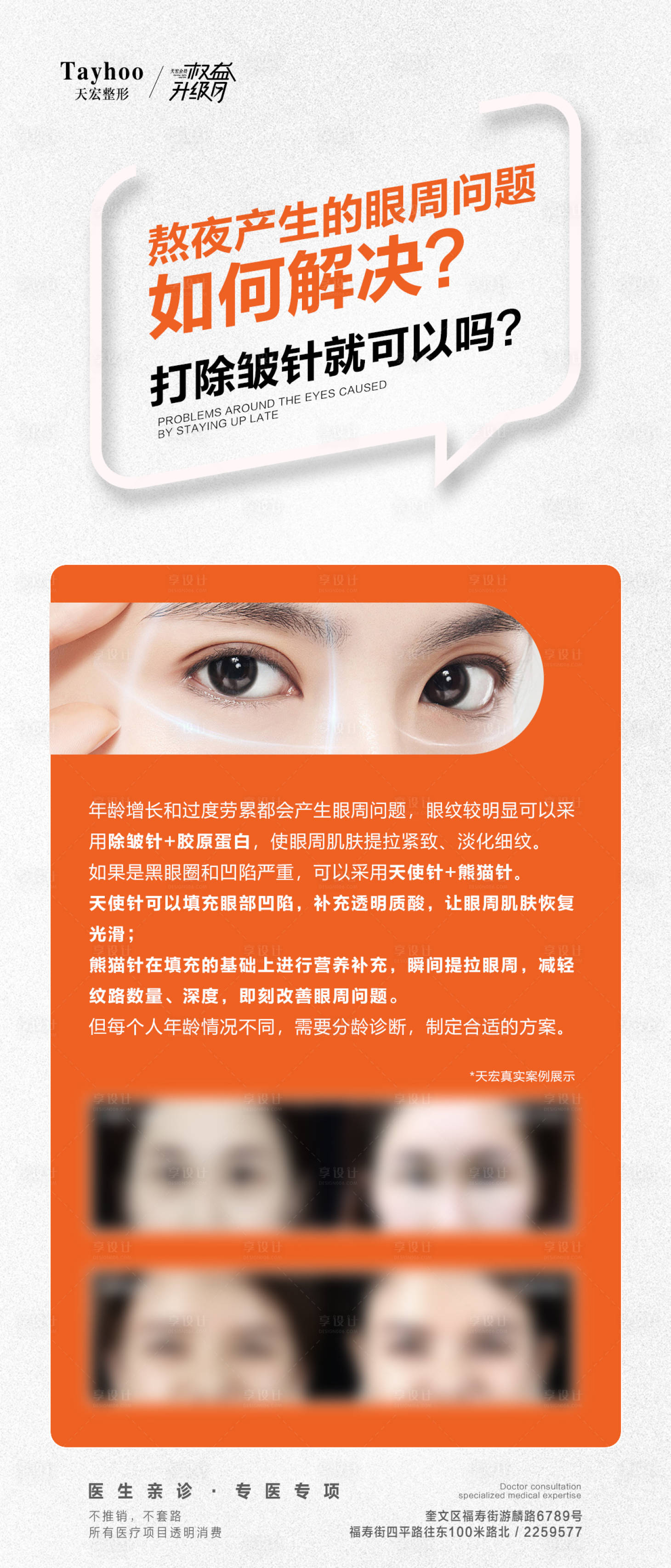 源文件下載【享設計】搜索編號：52520017917542965【眼周抗衰科普海報】