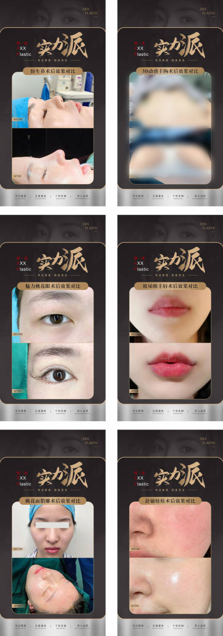 源文件下载【医美整形美容案例对比海报】编号：37590017878917606