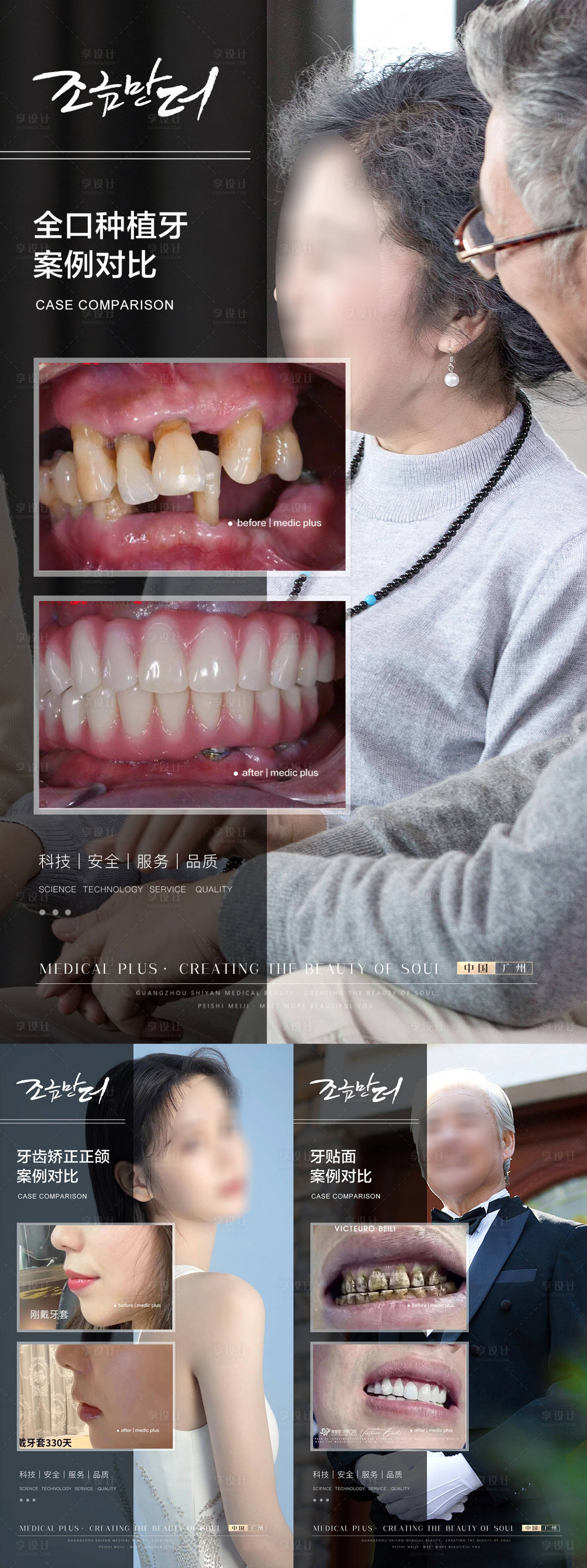 源文件下载【享设计】搜索编号：64740018298688289【口腔案例系列海报】