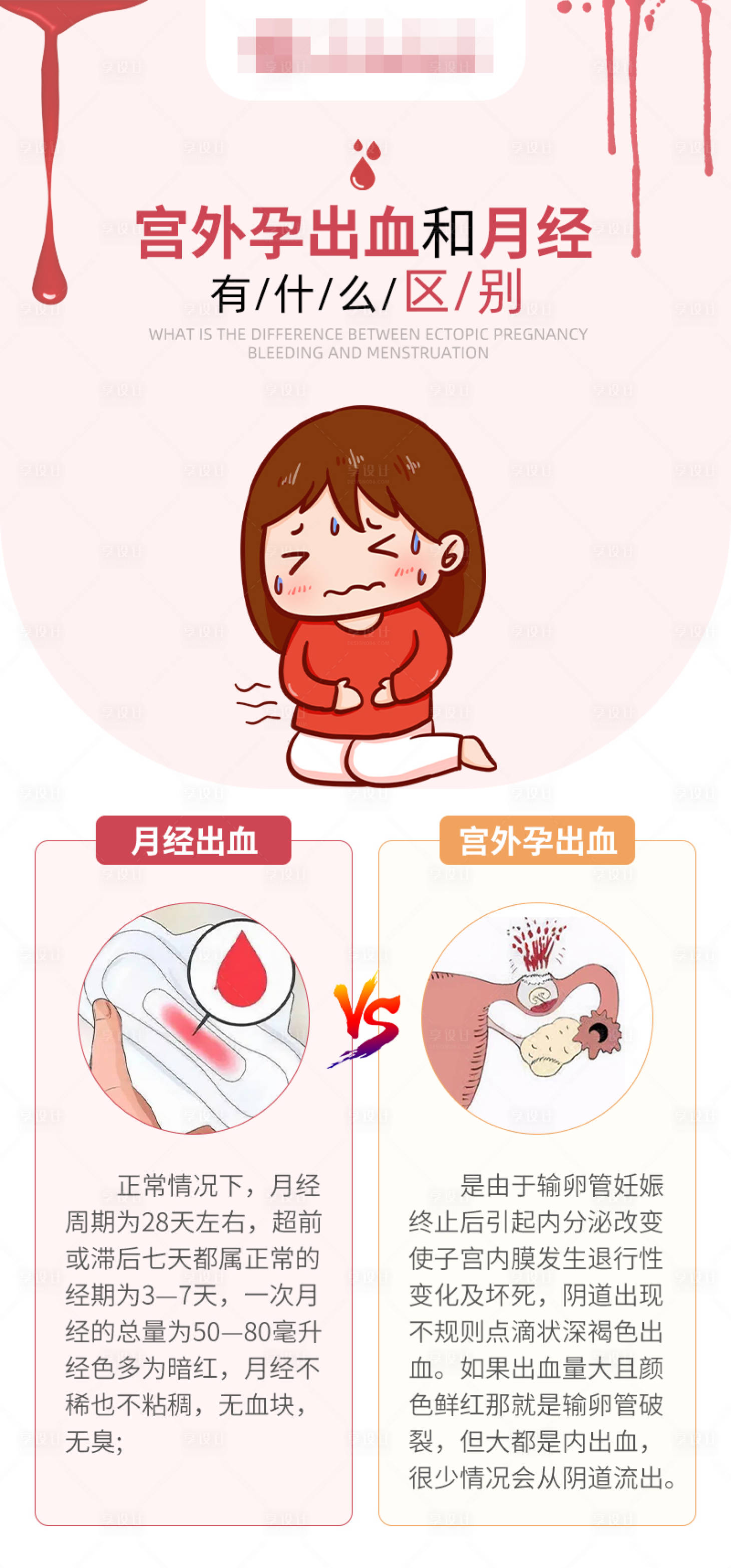 源文件下载【享设计】搜索编号：27980018007071210【宫外孕出血和月经区别海报】