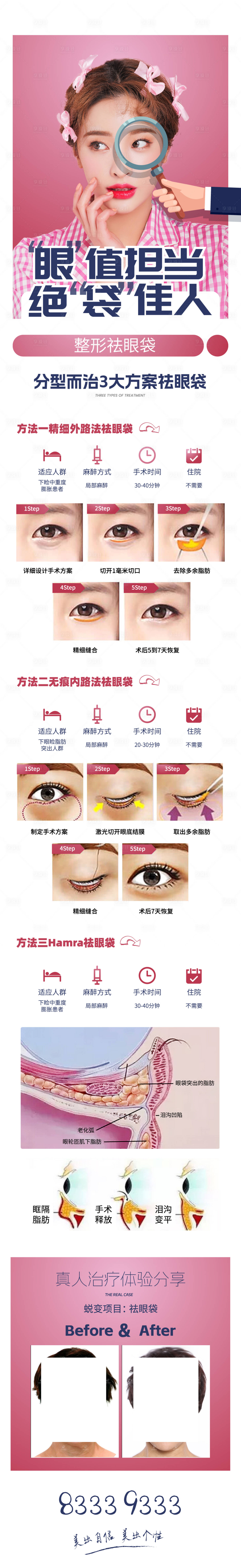 源文件下载【享设计】搜索编号：44270018171588575【医疗整形祛眼袋项目专题页】