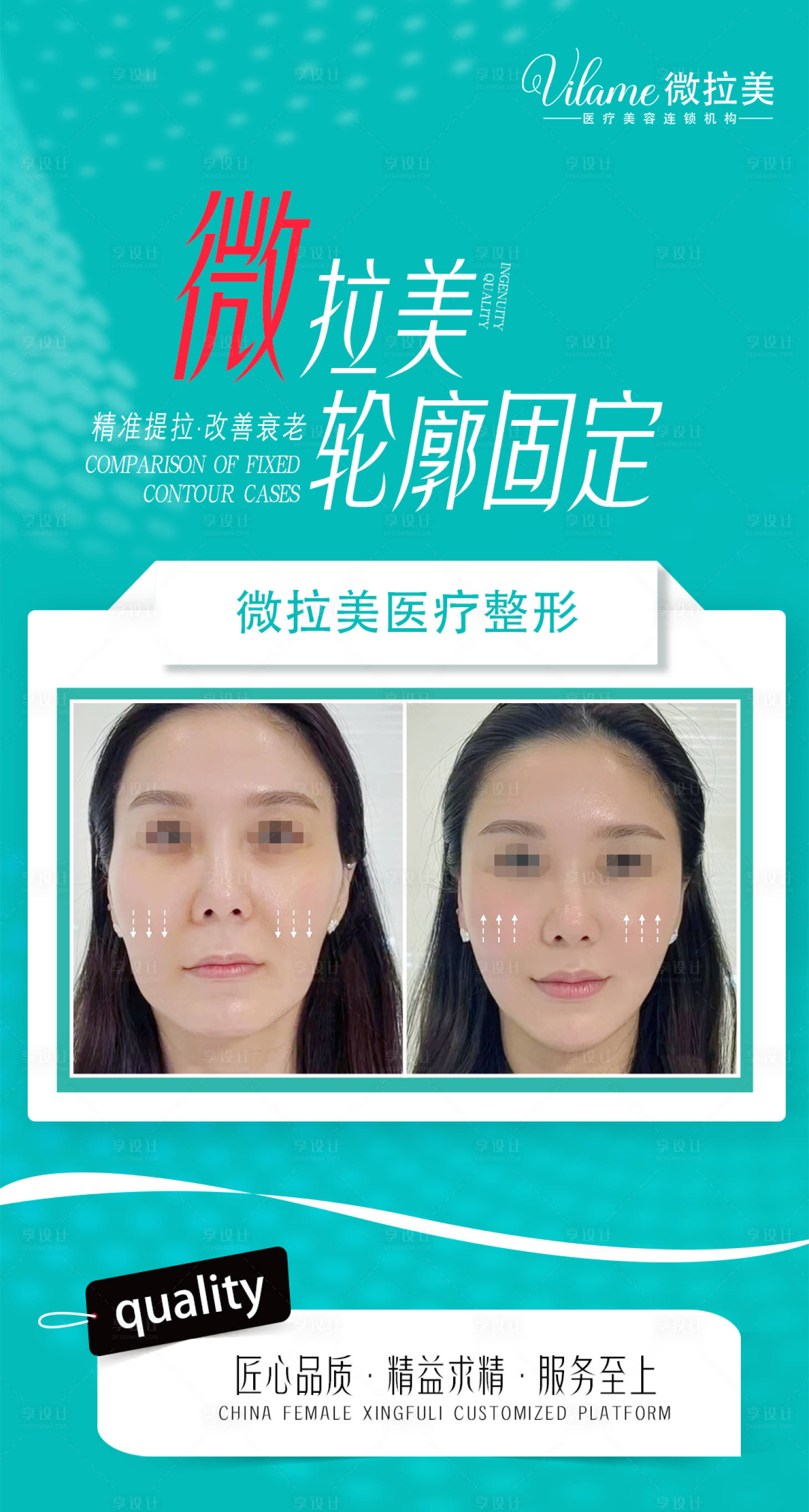 源文件下載【醫美案例對比圖海報】編號：61330017986036789