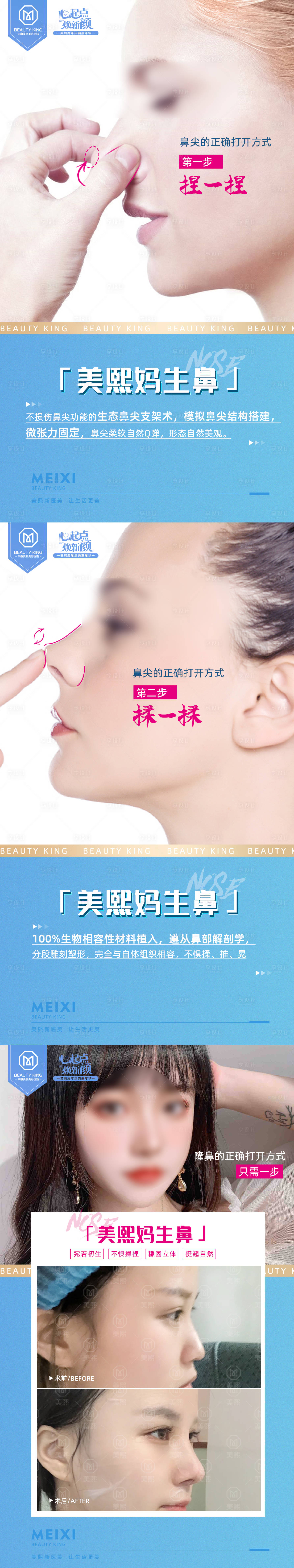 源文件下載【享設計】搜索編號：80840017780699165【隆鼻鼻尖案例海報】