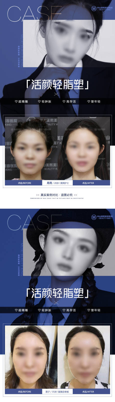 源文件下载【医美脸部填充案例海报】编号：93590017855643247