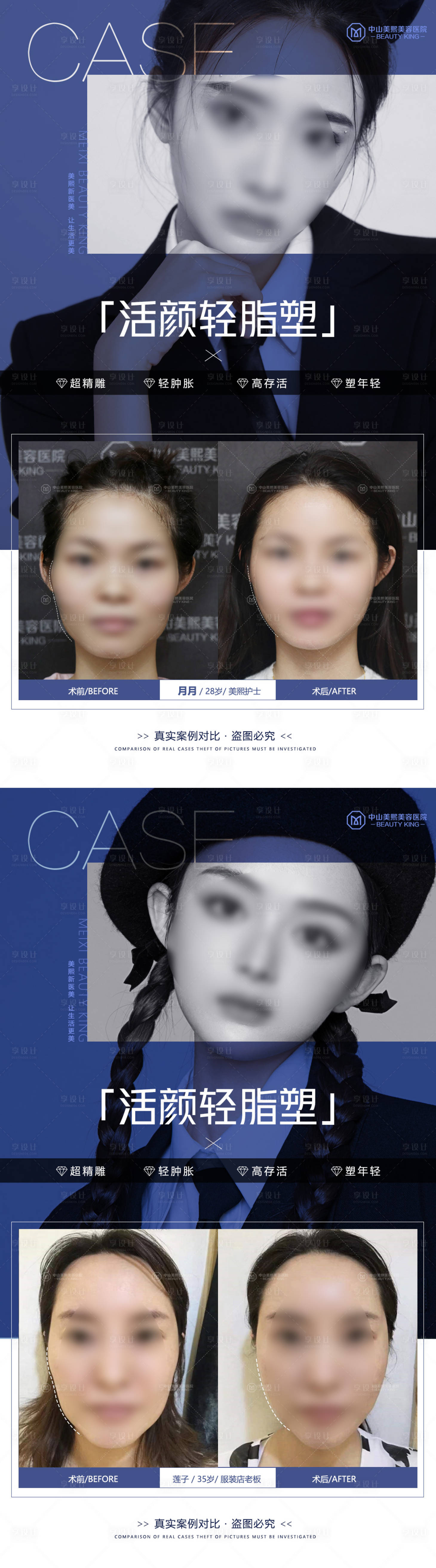 源文件下载【享设计】搜索编号：93590017855643247【医美脸部填充案例海报】