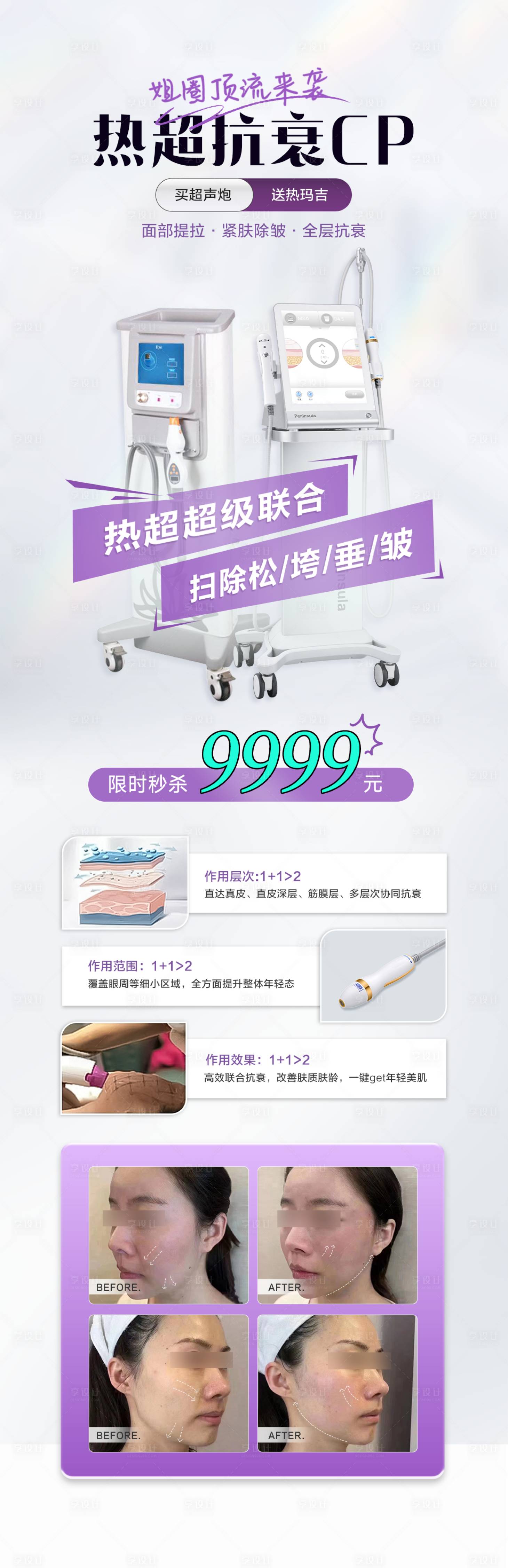 源文件下载【医美超热抗衰cp仪器联合海报】编号：77420017799229603