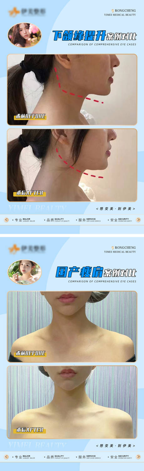 源文件下载【享设计】搜索编号：79280018315699920【医美案例对比模版】