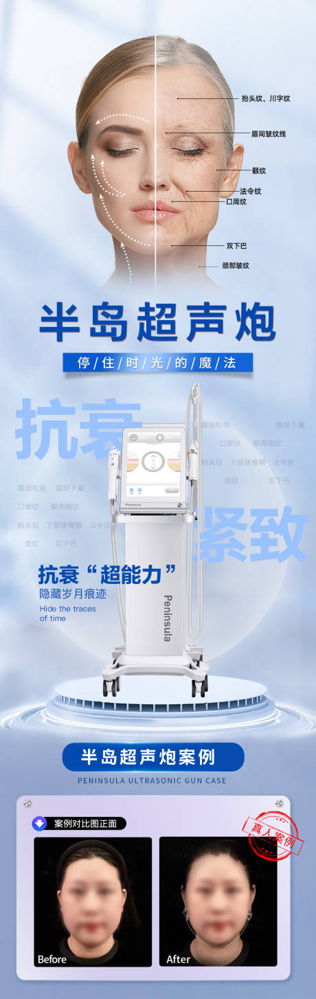 源文件下载【超声炮抗衰海报】编号：18440018341845839