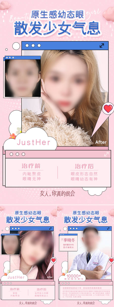 源文件下载【双眼皮案例对比海报】编号：78940018283309967