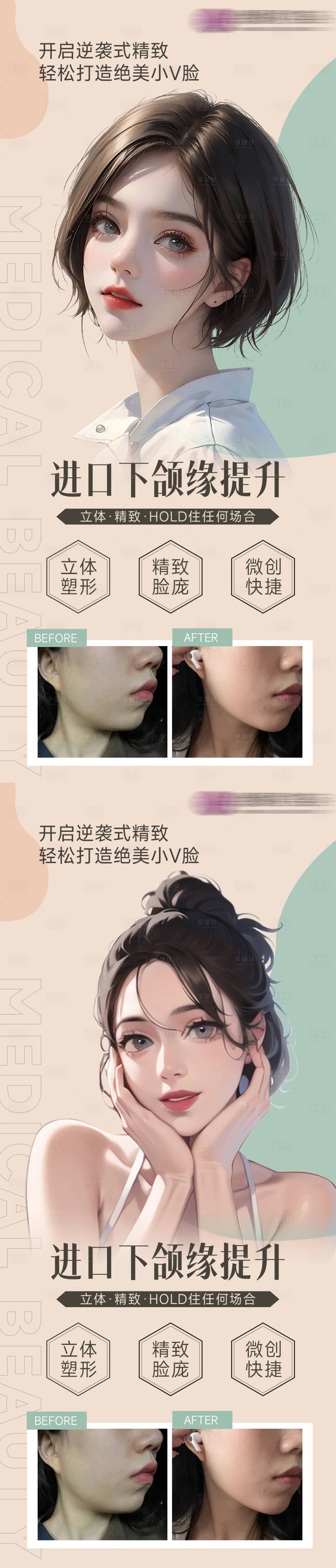 源文件下載【下頜緣提升海報】編號：40040018201778567