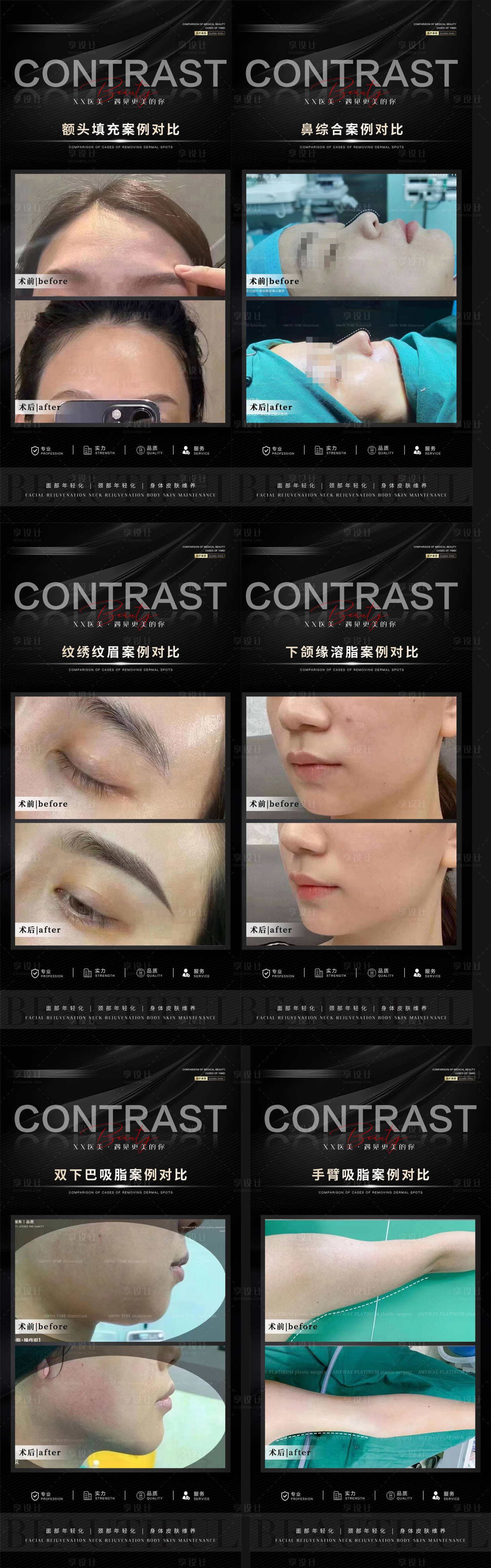 源文件下載【整形案例合集】編號：87240017928626140