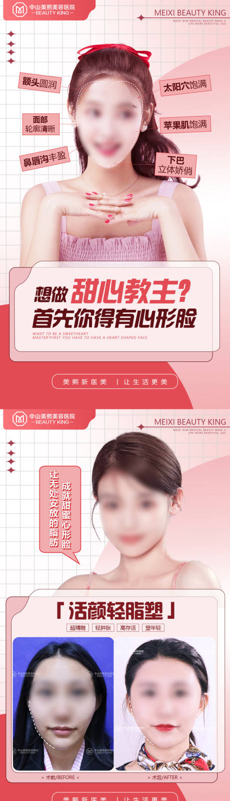 源文件下载【心形脸特点案例海报】编号：65360018045603975