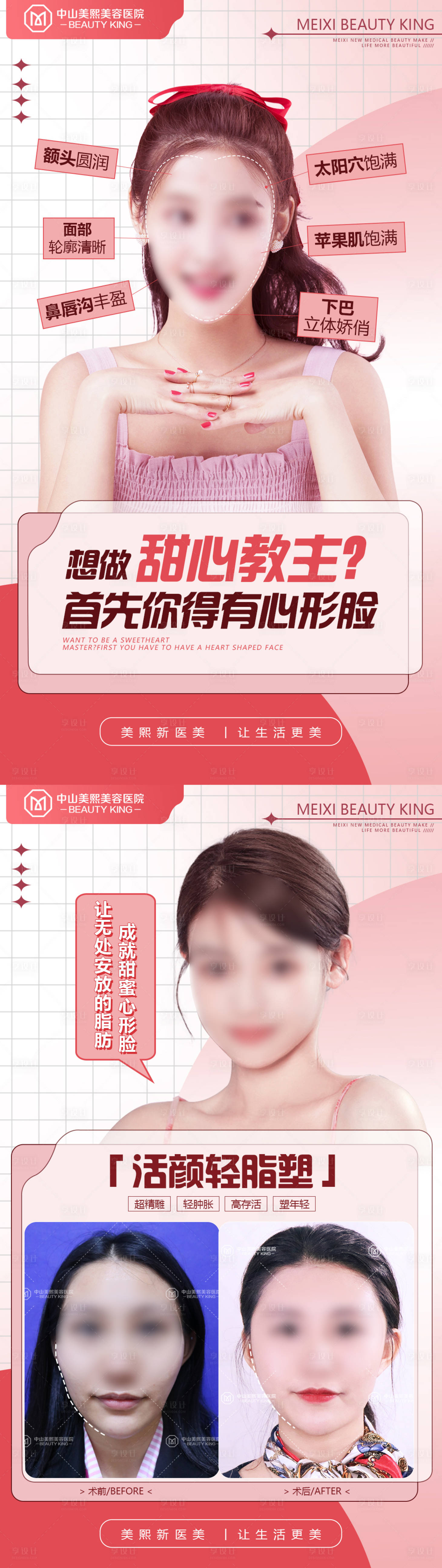 源文件下載【心形臉特點案例海報】編號：65360018045603975