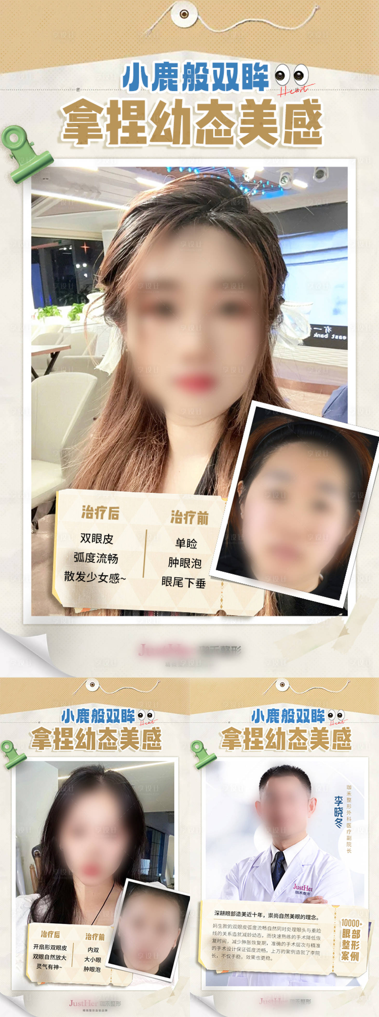 源文件下载【双眼皮案例对比海报】编号：88010018308561897