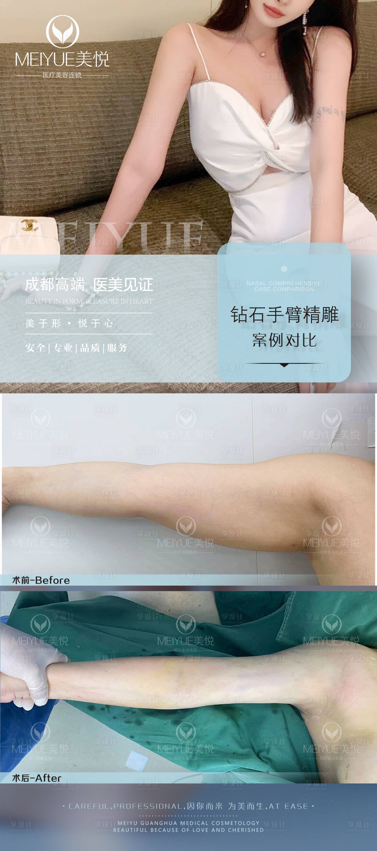 源文件下载【医美案例】编号：55950018294565447