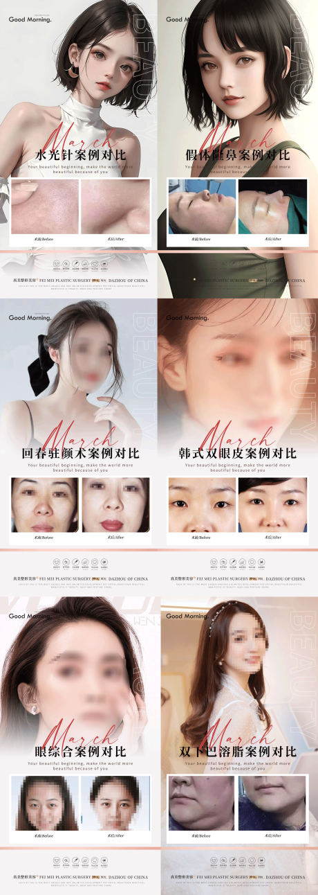 源文件下载【整形案例合集】编号：21420018200783618