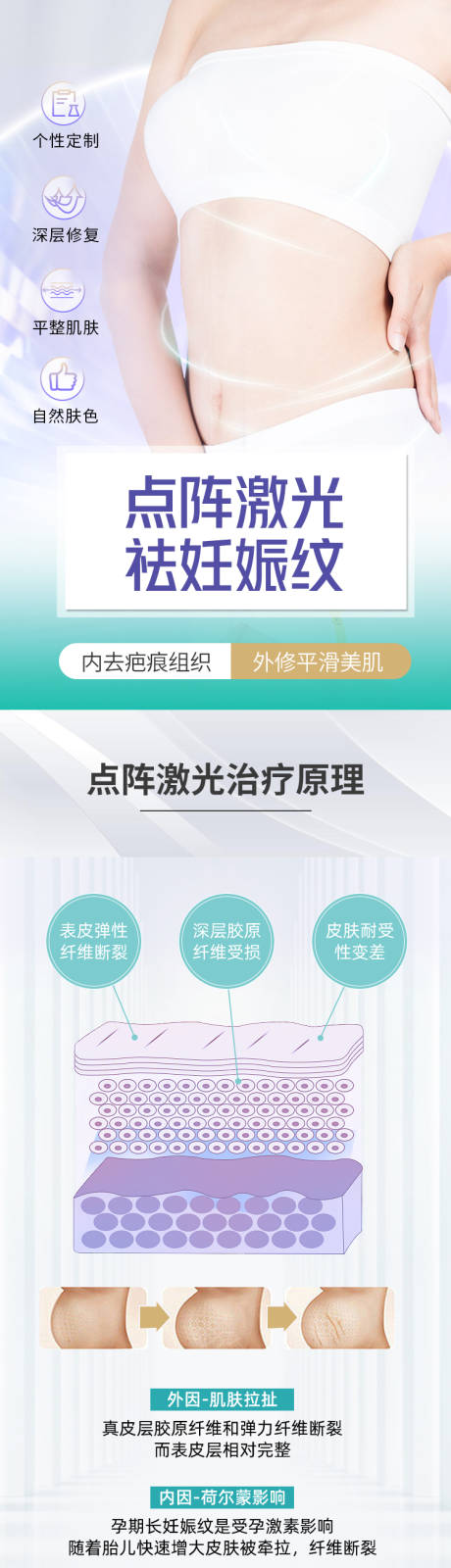 源文件下载【享设计】搜索编号：46710018157666820【医美点阵激光祛妊娠纹详情页】