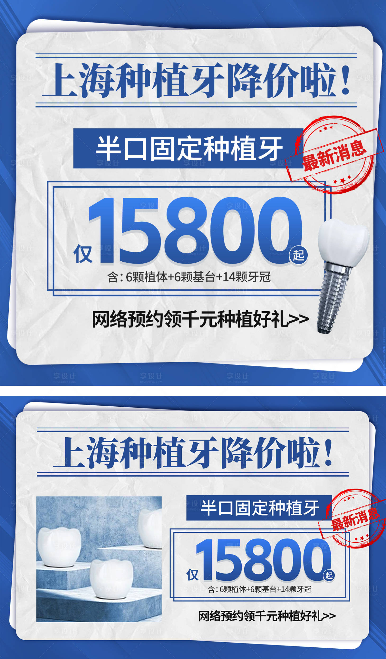 源文件下载【享设计】搜索编号：88230018343006759【种植牙banner入口图】