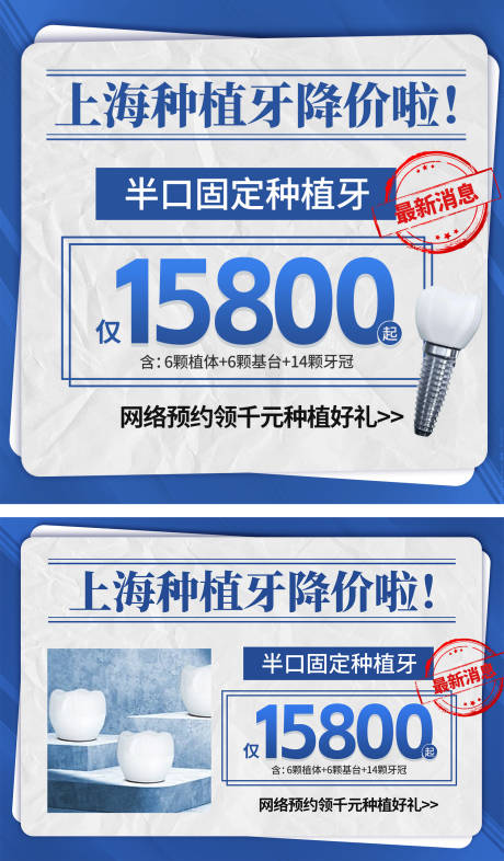 源文件下载【种植牙banner入口图】编号：20230727160819436