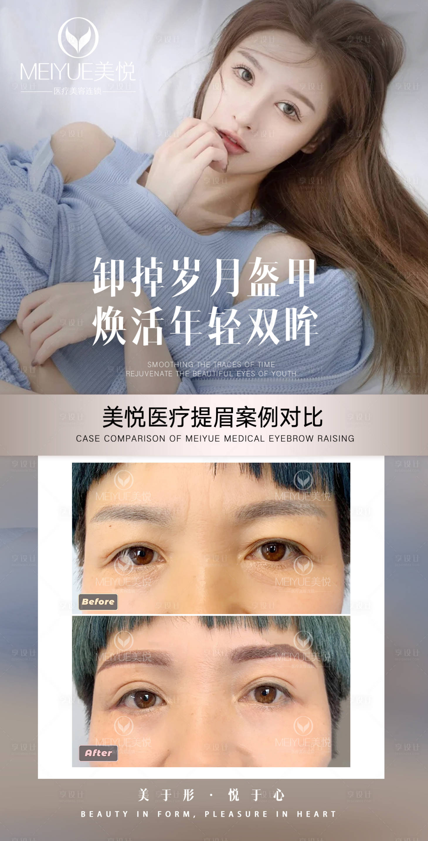 源文件下载【享设计】搜索编号：90060018294591837【医美案例对比海报】