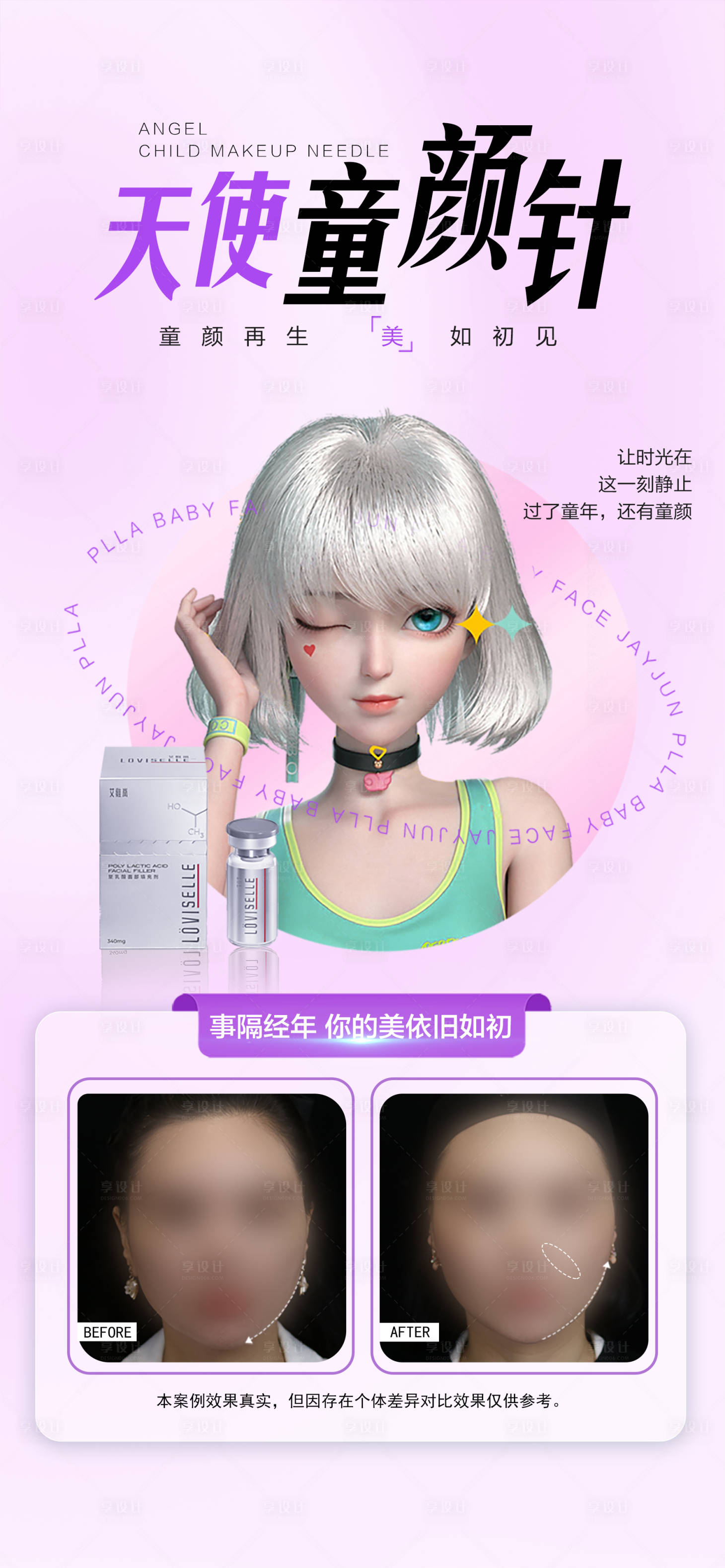 源文件下載【享設計】搜索編號：38950018302163871【童顏針醫美海報】