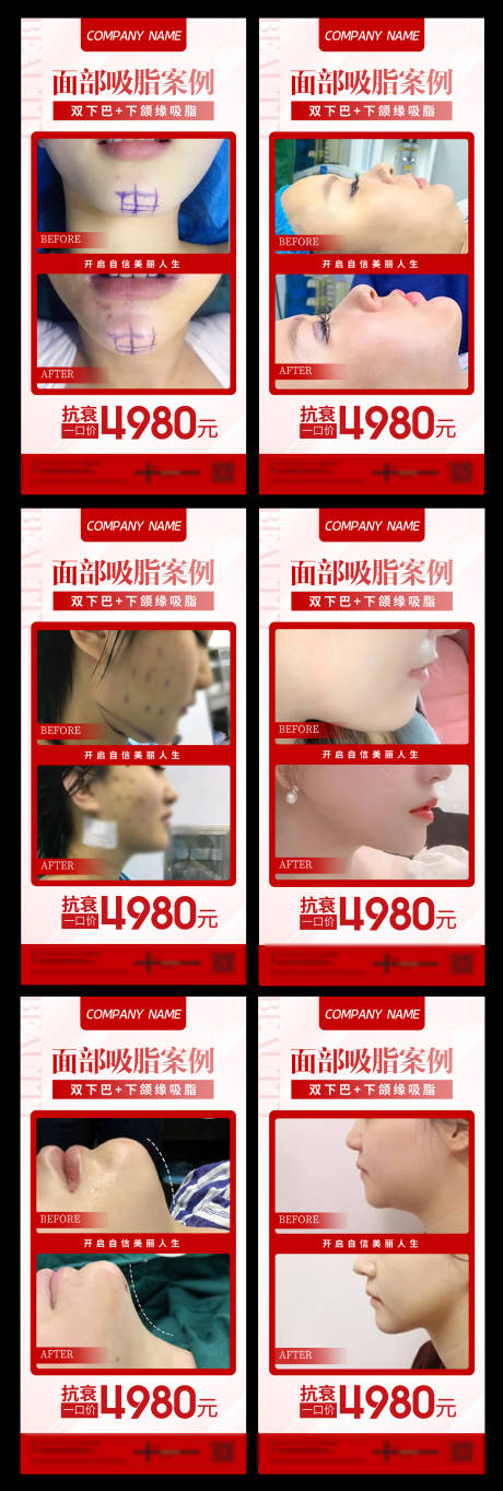源文件下载【面部吸脂案例宣传系列海报】编号：85580017920456518