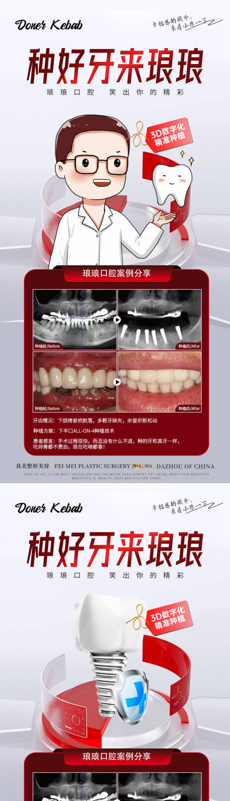源文件下載【種植牙活動案例海報】編號：96740018352725342