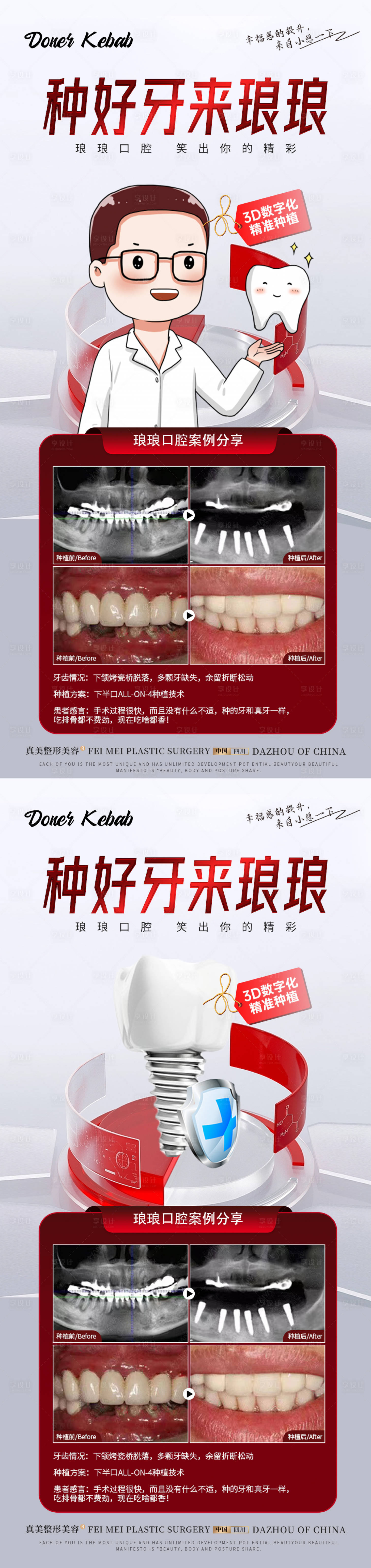 编号：20230728092008446【享设计】源文件下载-种植牙活动案例海报
