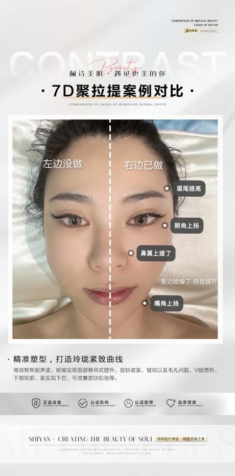 源文件下載【享設計】搜索編號：11780018102281923【7D聚拉提面部提升筋膜提升年輕化對比】