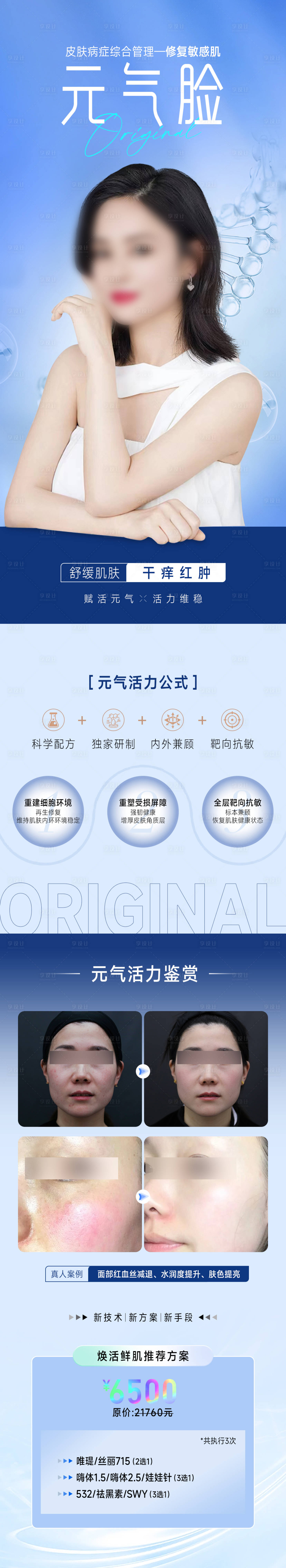源文件下載【享設(shè)計(jì)】搜索編號(hào)：25910018330601244【醫(yī)美敏感肌案例長(zhǎng)圖】