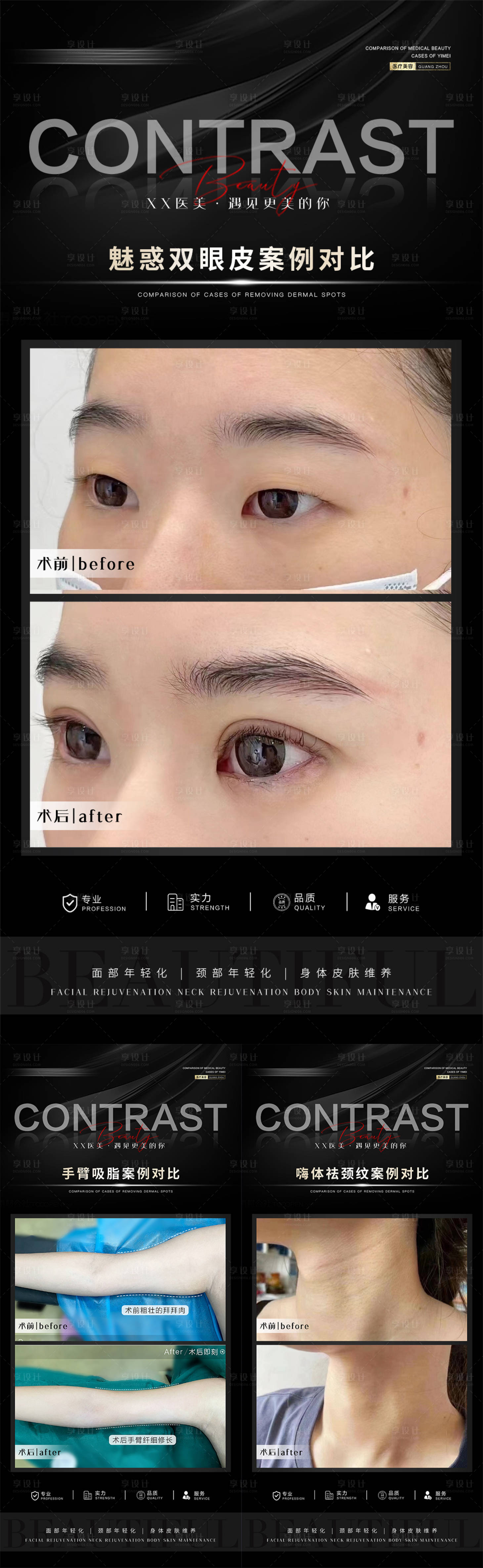 源文件下载【享设计】搜索编号：88740018062134376【医美案例系列对比海报】