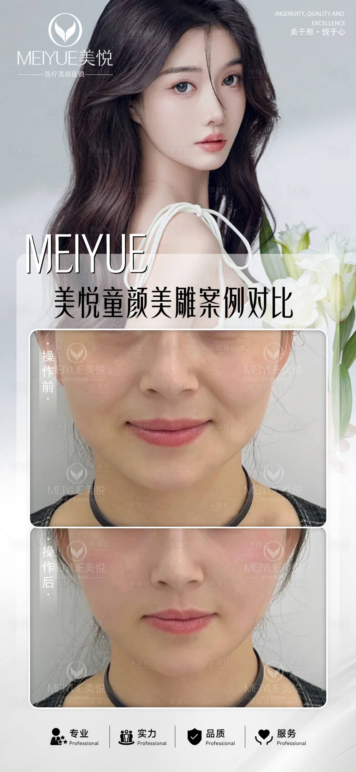 源文件下載【享設計】搜索編號：68330018281603340【醫美案例對比圖】