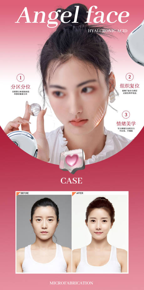 源文件下载【享设计】搜索编号：15620018412172801【玻尿酸案例海报】