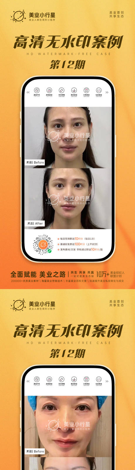 源文件下载【医美整形美容美业高清案例对比素材】编号：70210018393254198