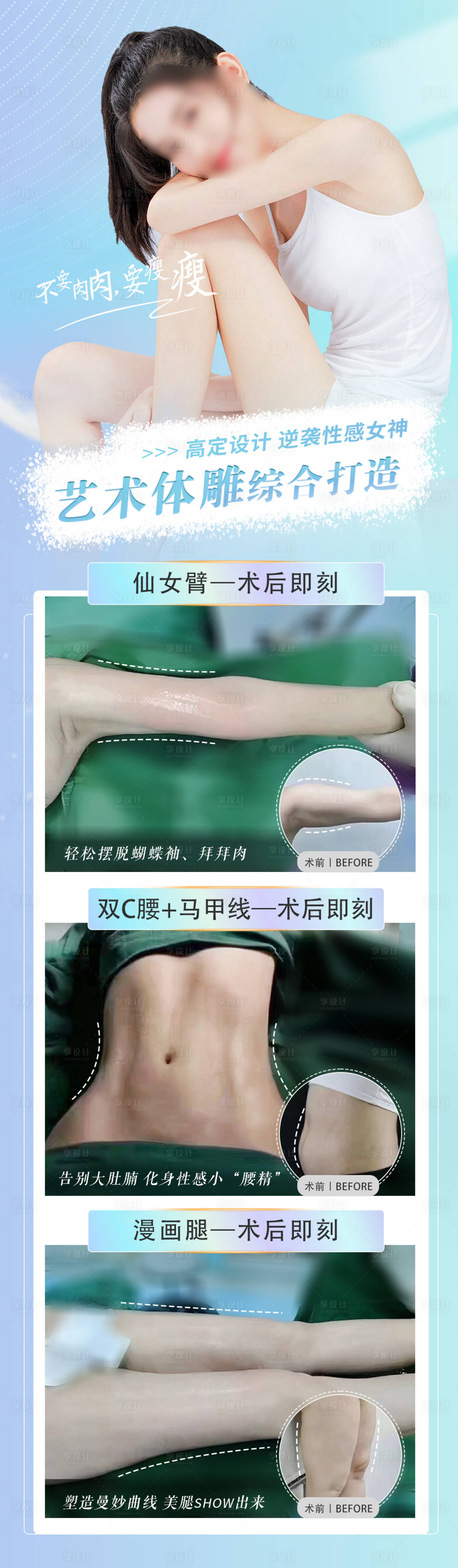 源文件下载【享设计】搜索编号：40330018317463162【吸脂艺术体雕案例】