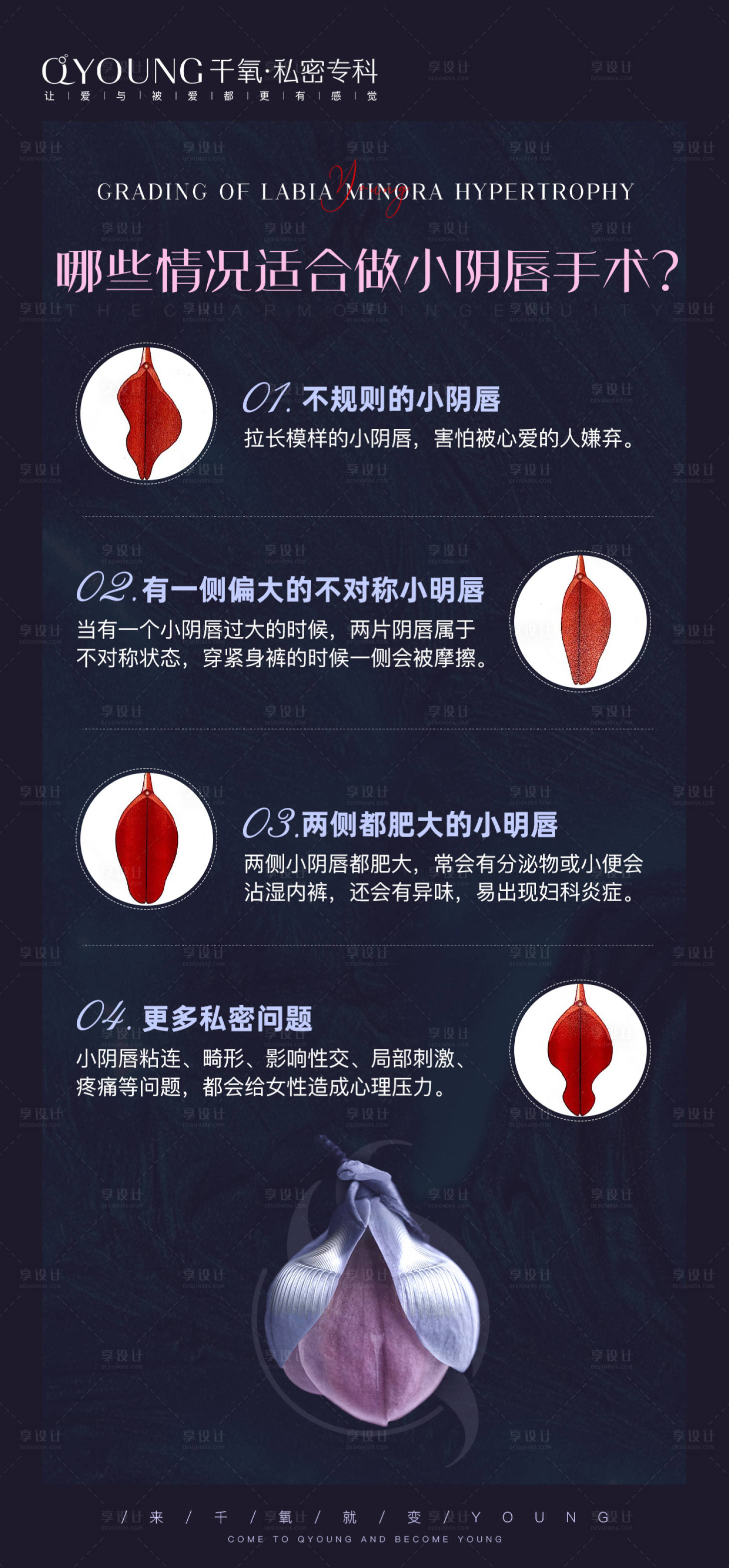 小阴唇 