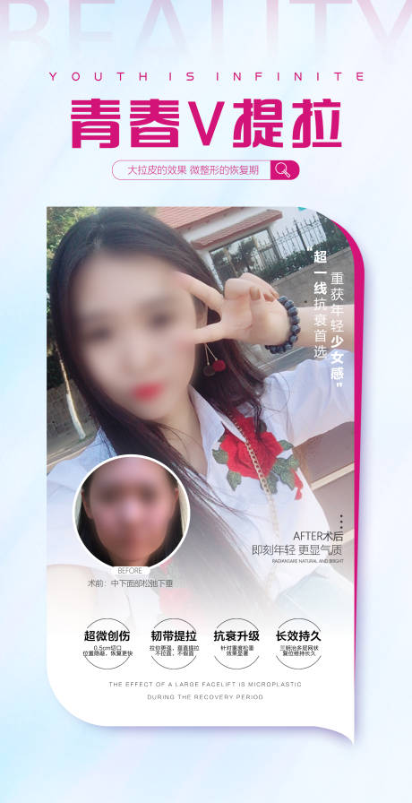 源文件下載【醫美案例海報】編號：67600018288935555