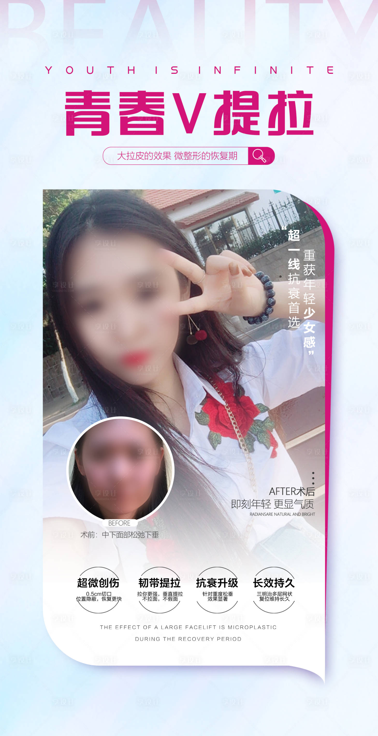 源文件下載【享設計】搜索編號：67600018288935555【醫美案例海報】